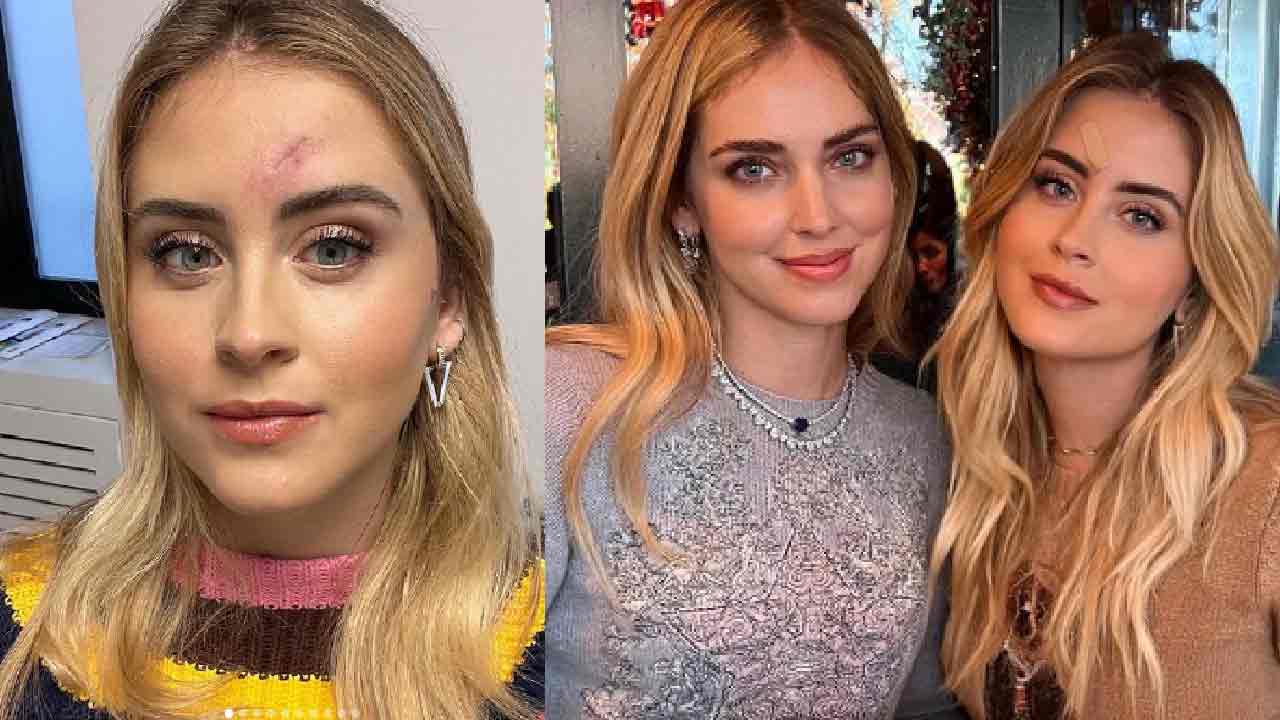 Valentina Ferragni, la sorella dell'influencer ha rimosso un tumore maligno raro (Instagram)