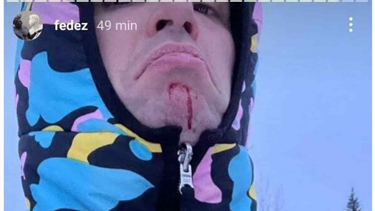 Fedez, incidente in montagna (fonte: instagram)