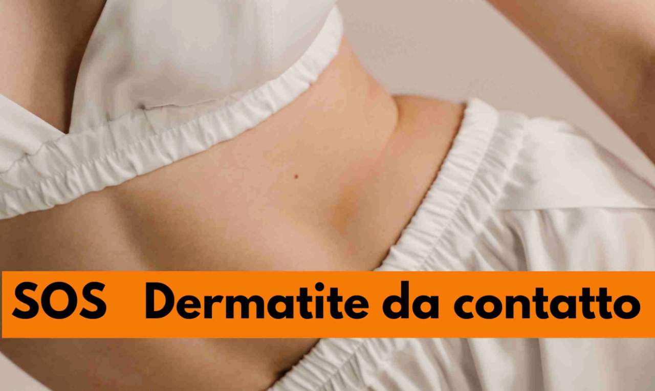 Dermatite da contatto