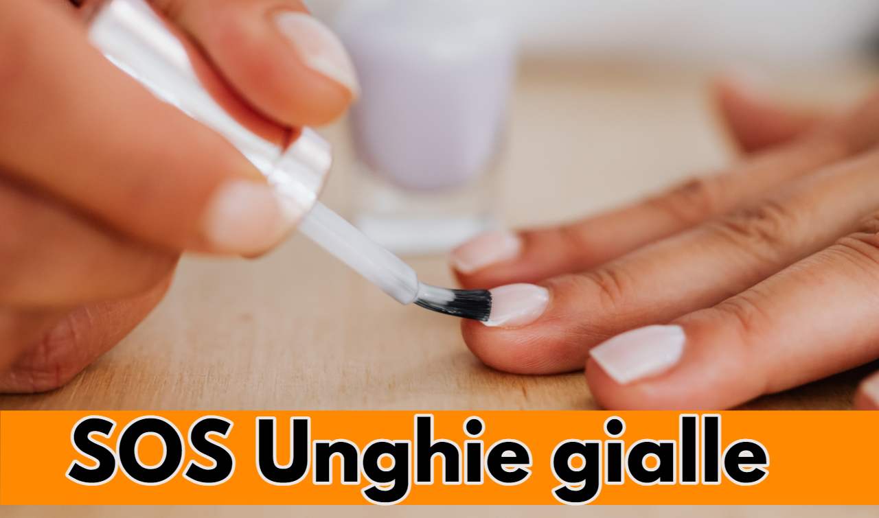 SOS unghie gialle