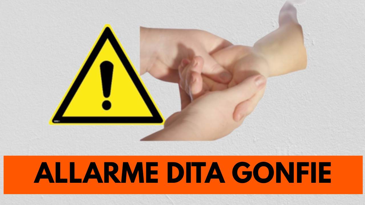 Dita mani gonfie allarme