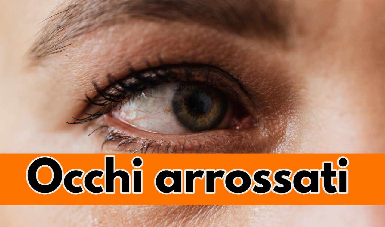 occhi arrossati e lacrimanti