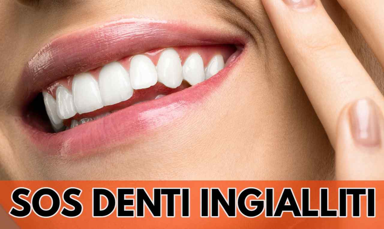denti ingialliti ck12.it 20220905