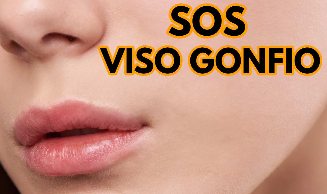 viso gonfio ck12.it 20220926